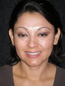 Before treatment, case 3